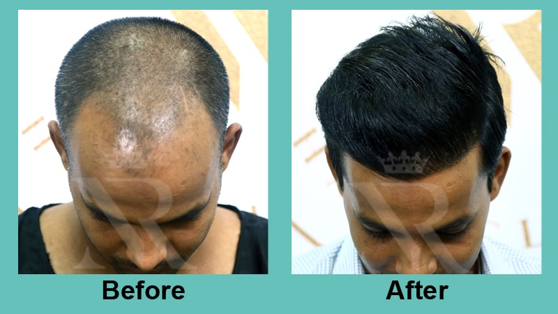 01_Sapphire-Fue_Result.jpg