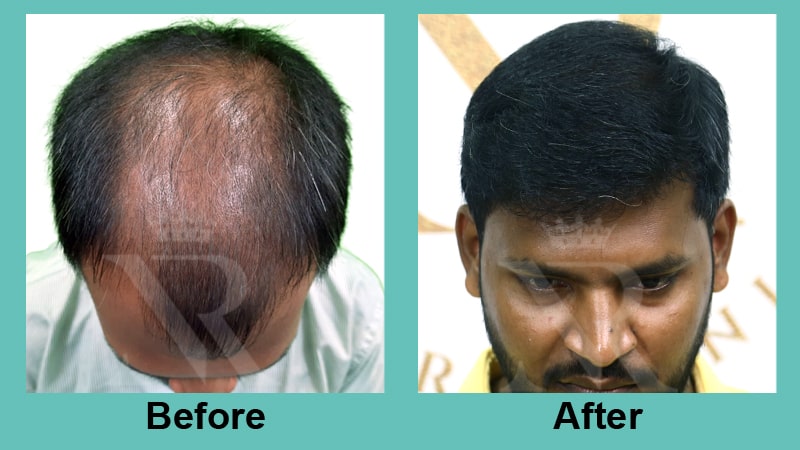 02_Sapphire-Fue_Result.jpg