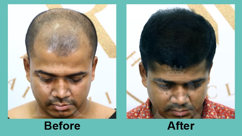 04_Sapphire-Fue_Result.jpg