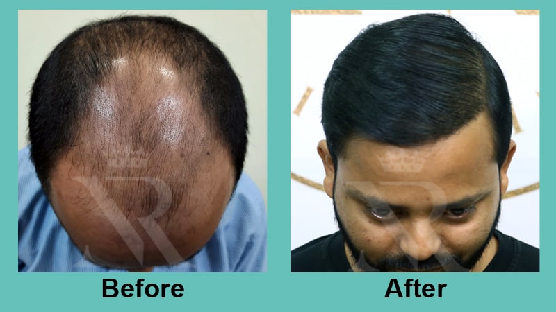 05_Sapphire-Fue_Result.jpg