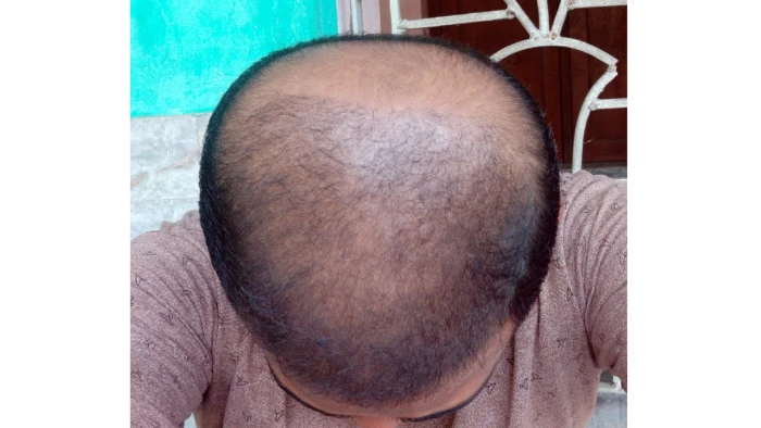 After 2 month