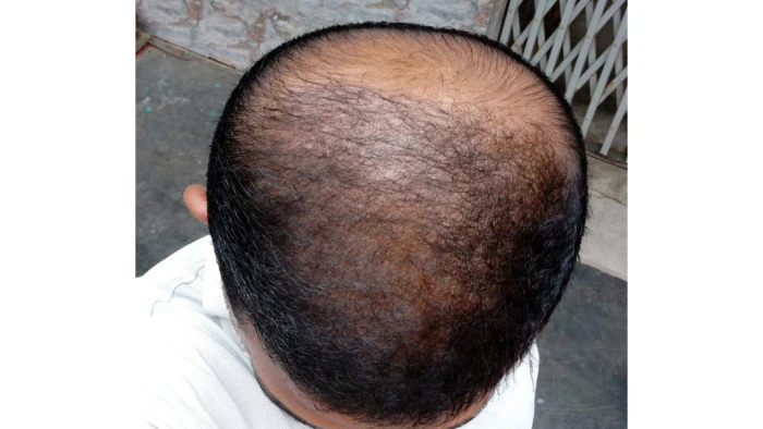 After 3 month