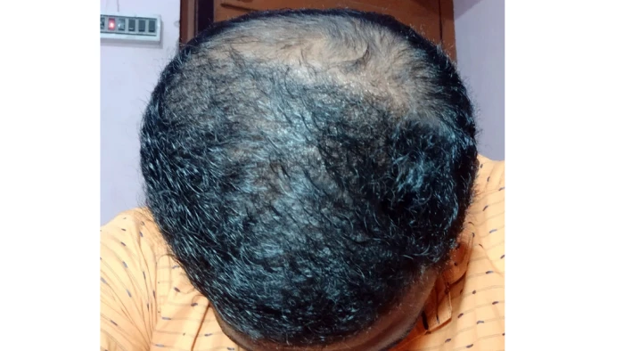After 4 month