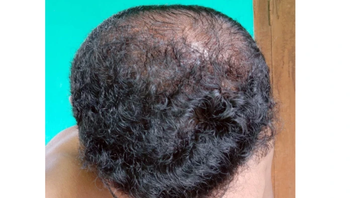 After 5 month