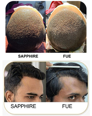 Sapphire-vs-fue.jpg