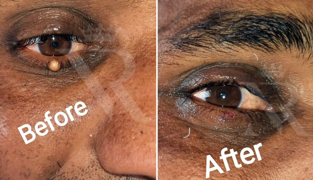 Skin-Growth-result-01.jpg