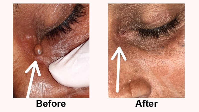 Skin-Growth-result-02.jpg