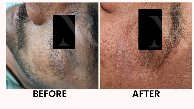 Skin-Growth-result-03.jpg