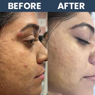 best skin treatment clinic