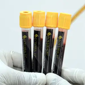 prp treatment for hair