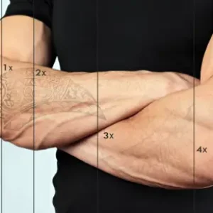 tattoo removal clinic