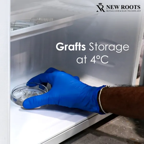 Grafts Storage