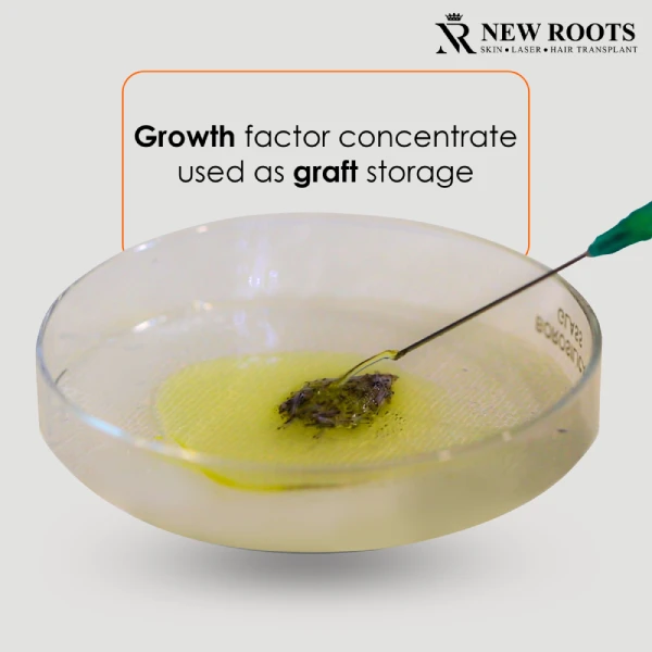 Growth Factor Concentrate