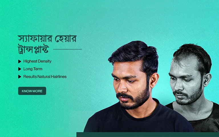 hair transplant clinic in bangladesh