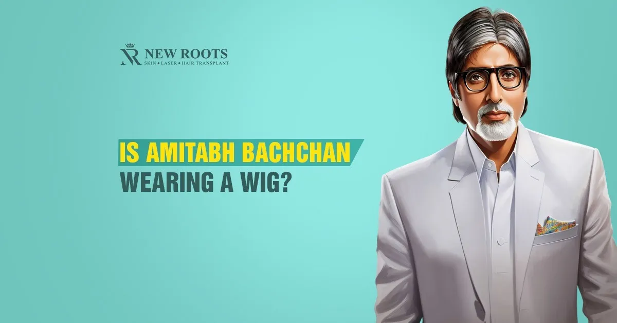 amitabh bachchan hair transplant