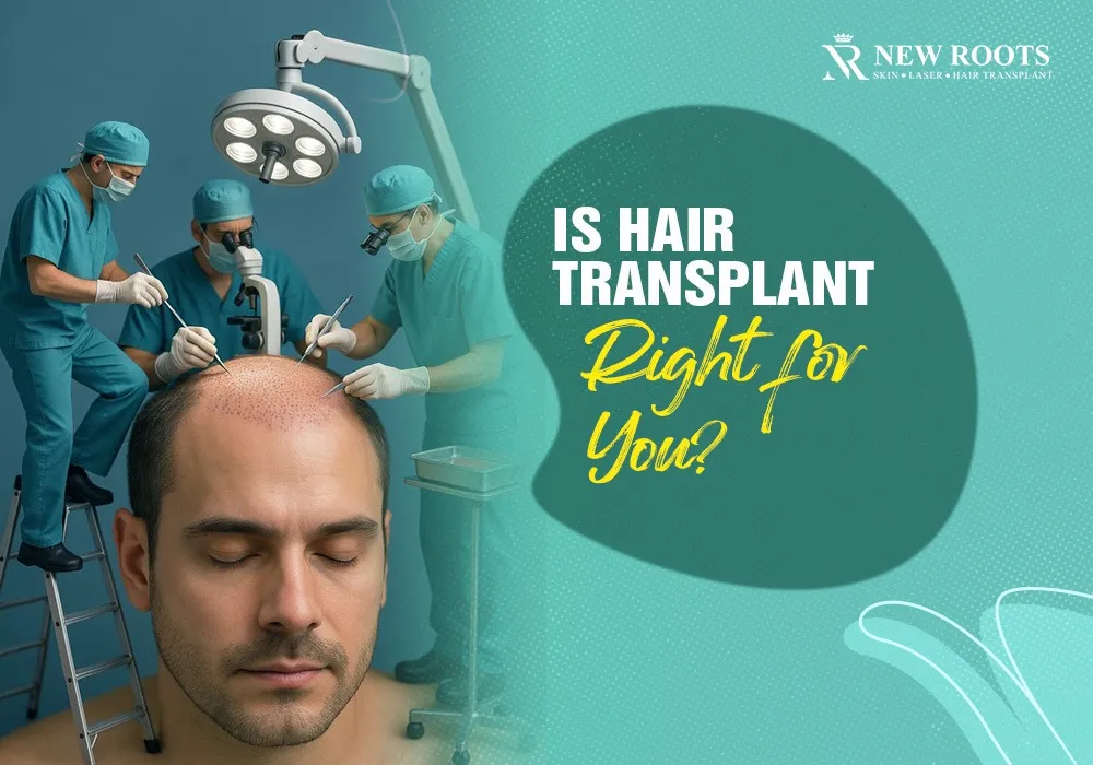 best age for hair transplant