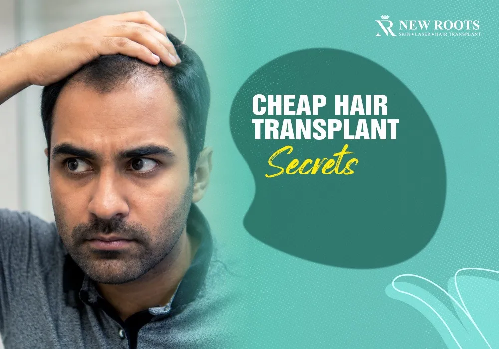 cheap hair transplant