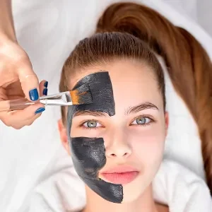 13_Carbon Peel Laser